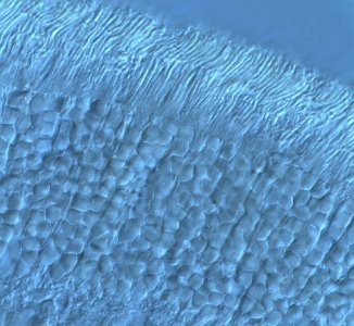 microscope image of a retina