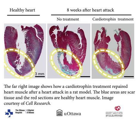 heart muscle after a heart attack