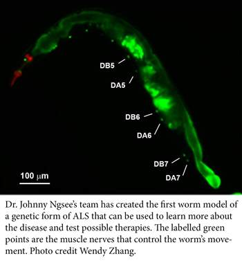 Fluorescent image of a worm used to study ALS