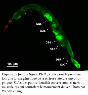Image fluorescente d'un ver utilisée pour étudier la SLA