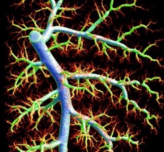 blood vessels in the lung