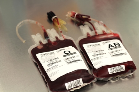two blood bags with blood in them