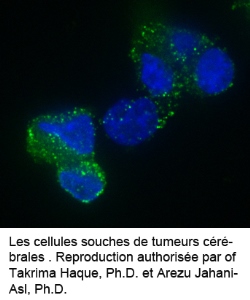 cellules dans le cerveau
