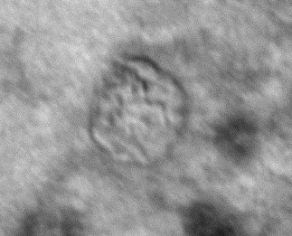 Exosomes are tiny membrane-bound vesicles released by cells