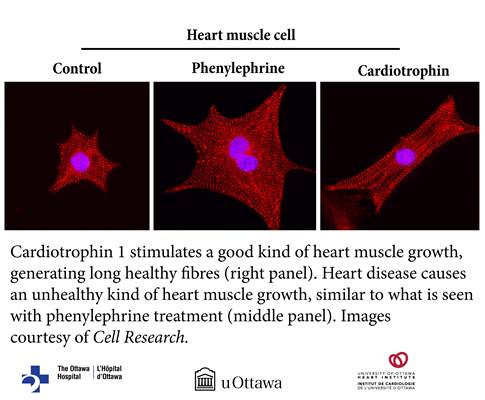 heart muscle cells
