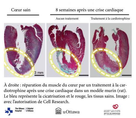 muscle cardiaque après une crise cardiaque