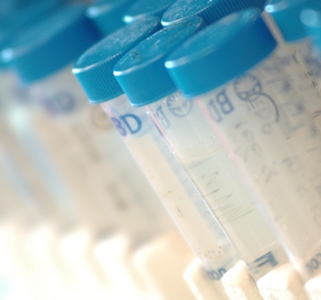 une rangée de tubes d'essai avec des capuchons bleus