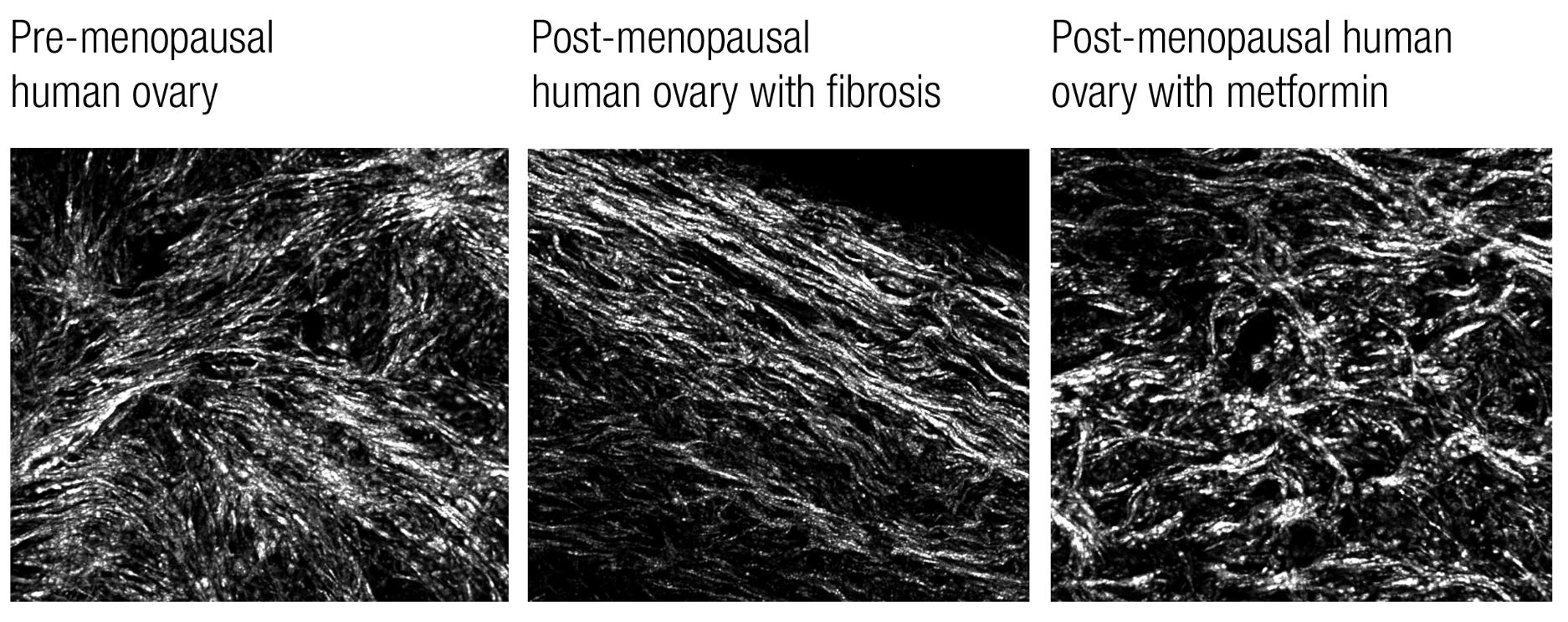 microscopic images of a human ovary
