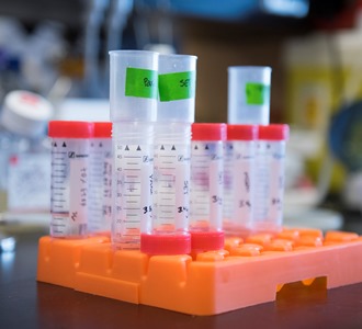 a table with a bunch of test tubes