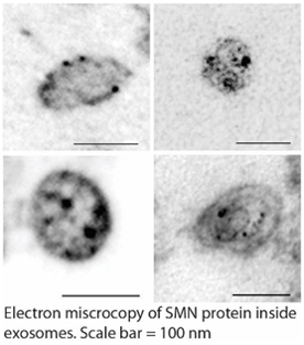 Electron microscopy of biological structure/component