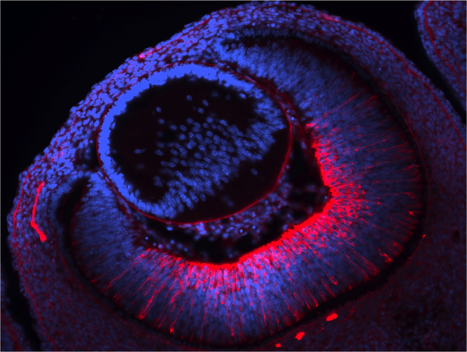 microscopic image of a developing eye structure