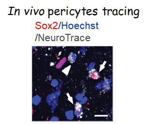 In vivo pericytes tracing