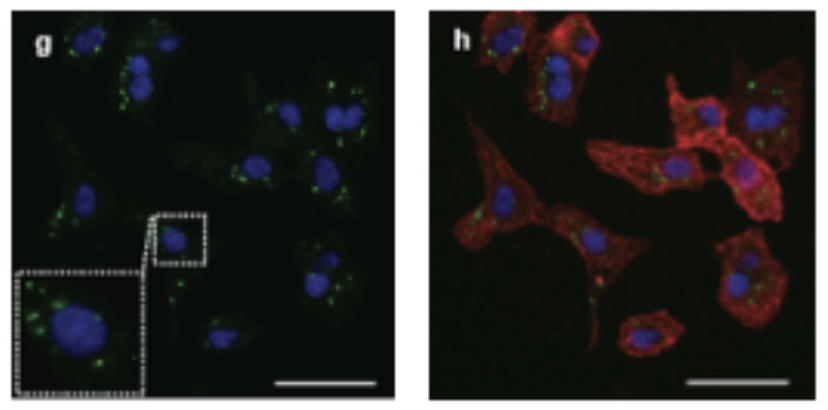 This confocal microscopy image depicts active caspase 3. (green staining) in cardiomyocytes (red staining) during the early stages of hypertrophic growth. The image on the left depicts the active caspase 3{green staining) in close proximity to the cell nucleus (blue staining)
