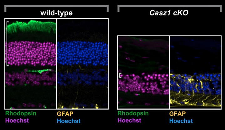 Age-dependent retinal degeneration in Casz1 conditional mutant retinas