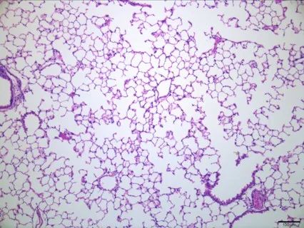 A closeup of an treated mouse lung