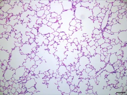 A close up of an untreated lung cell