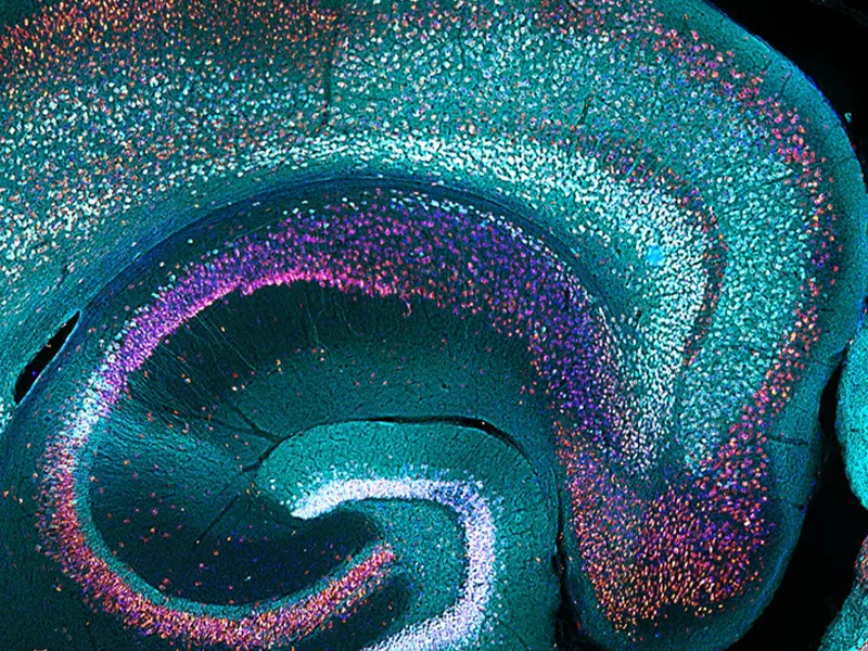 Brain tissue, magnified, with different kinds of cells stained in different colours
