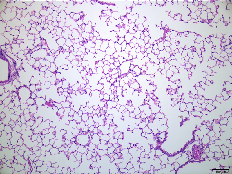 Mouse lung cells stained pink and purple