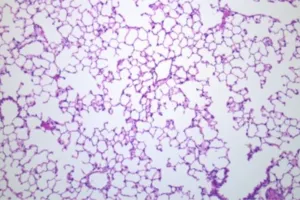 A close up of a treated lung