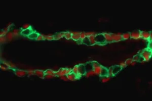 Mouse mammary gland viewed under a microscope