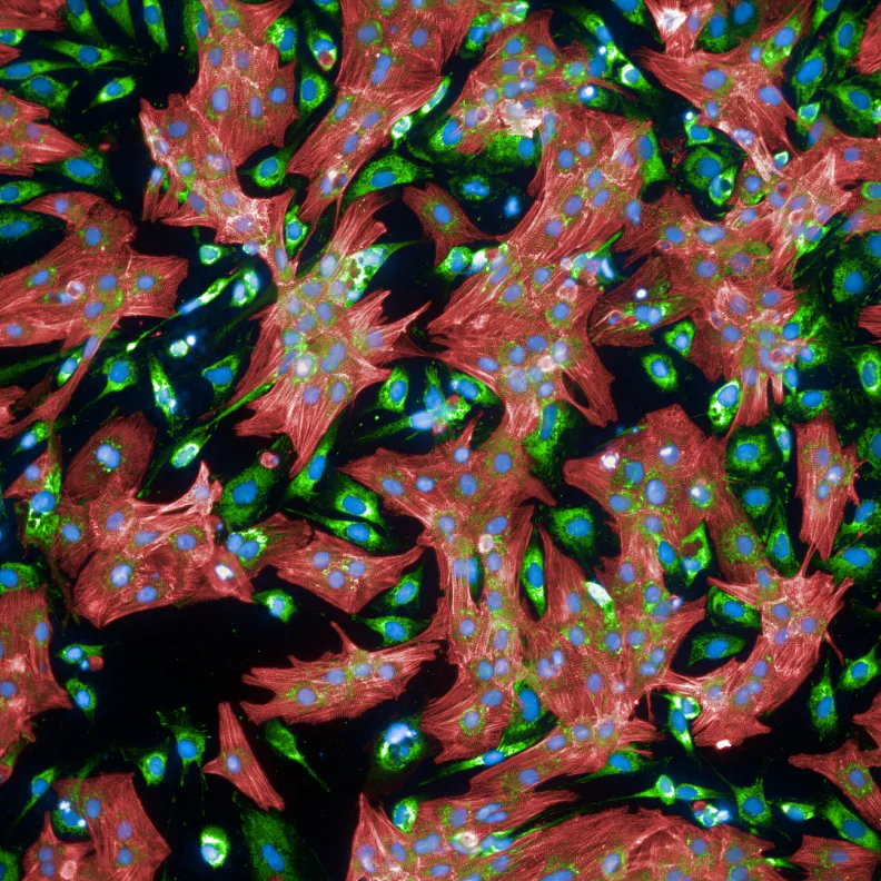 Immunofluorescence image of heart muscle cells from a rat, stained red to show their shape and structure.