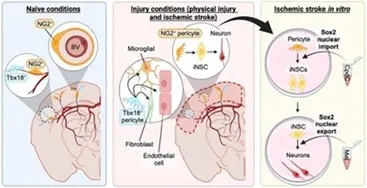 image of different conditions of brain cells