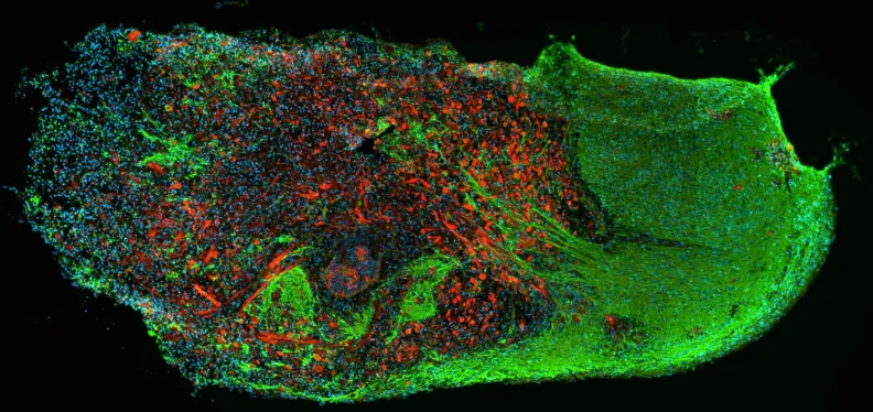 Green and red cells growing together in a lab dish